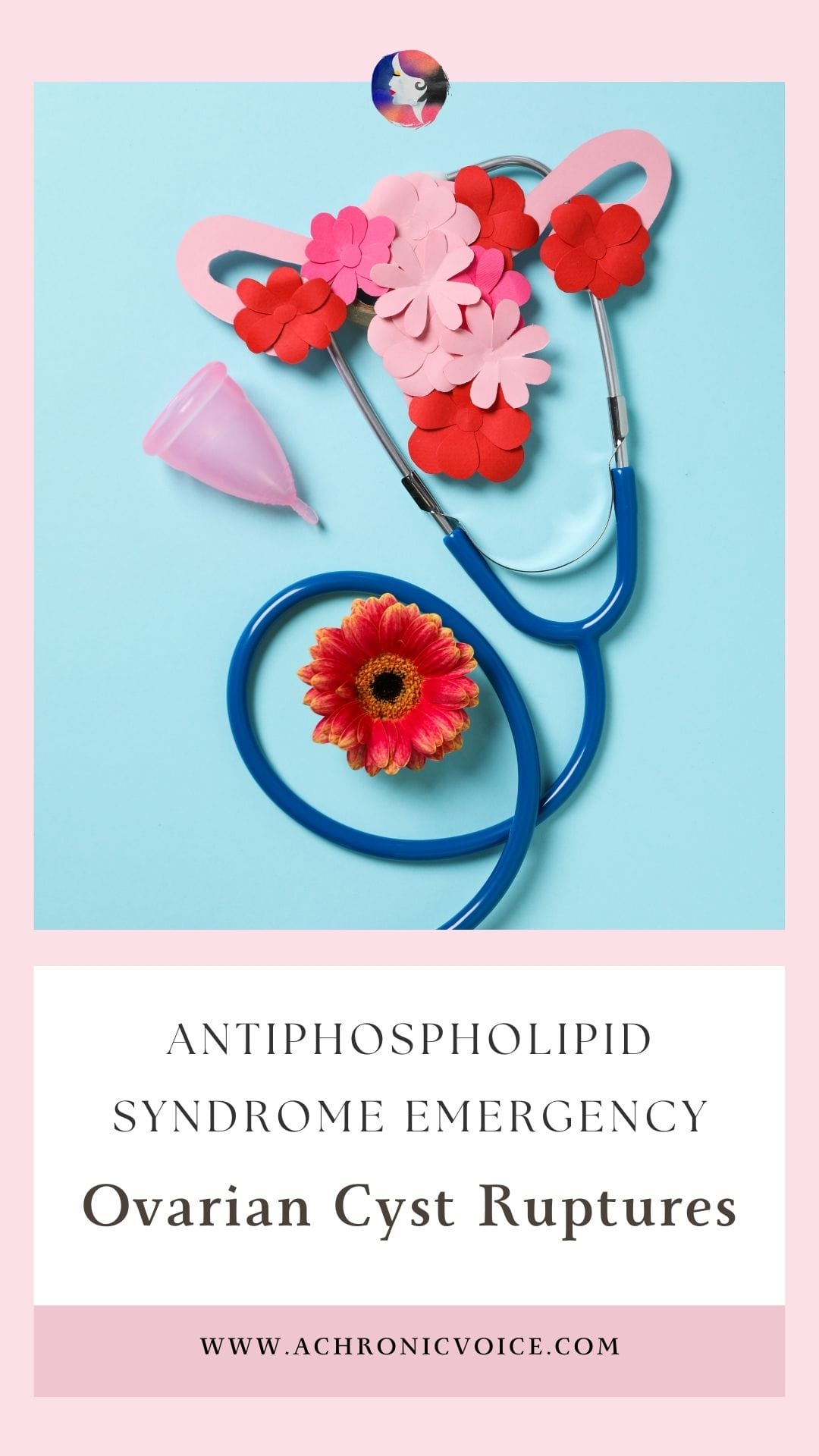 Antiphospholipid Syndrome Emergency - Ovarian Cyst Ruptures