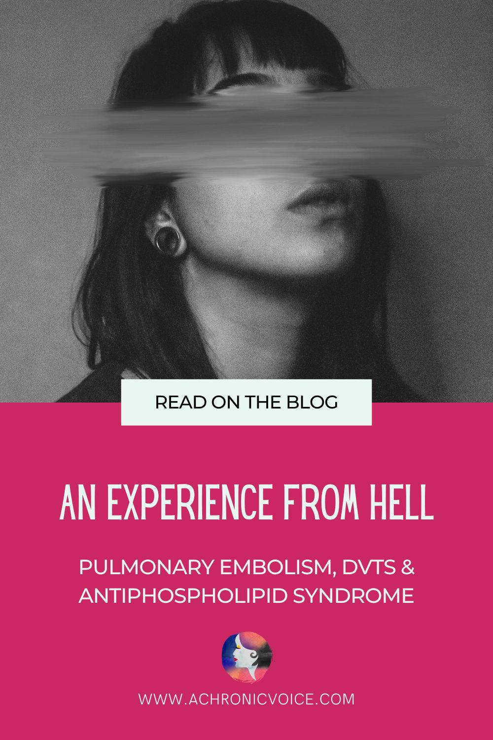 An Experience from Hell: Pulmonary Embolism, DVTs and Antiphospholipid Syndrome