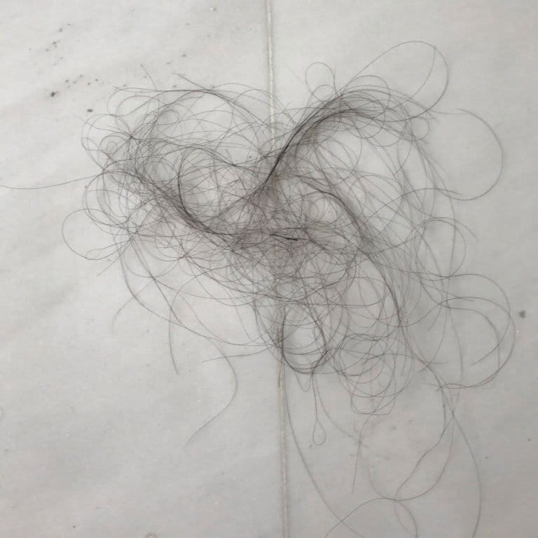 Hair loss from meds - achronicvoice.com