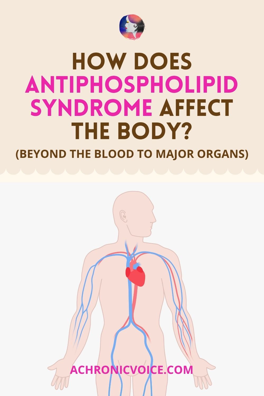 How Does Antiphospholipid Syndrome Affect The Body? (Beyond the Blood to Major Organs)