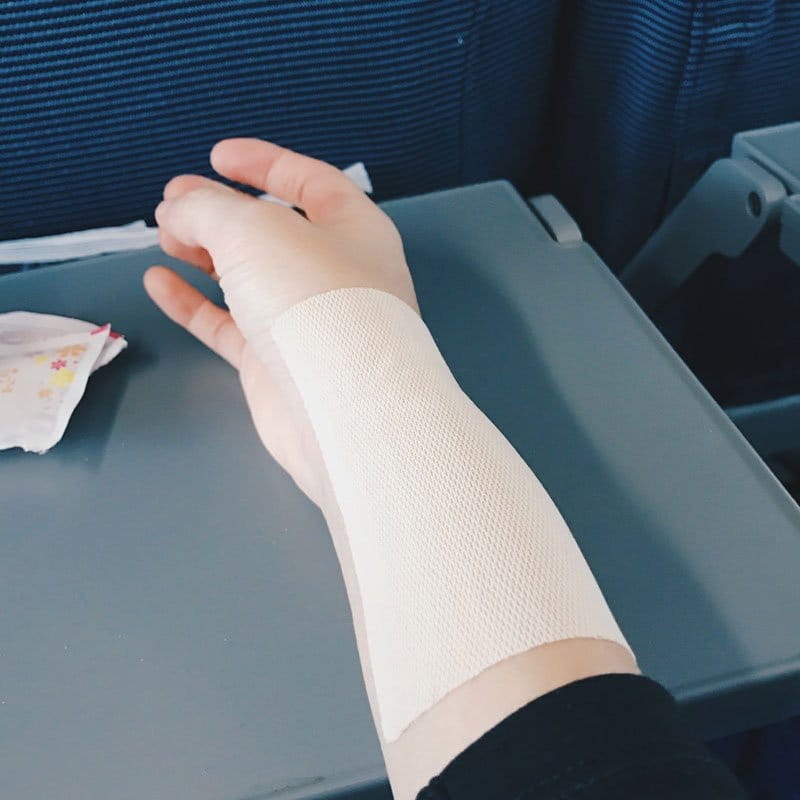 Kefentech anti-inflammatory plaster for lupus and sjögren flare - find out more at www.achronicvoice.com