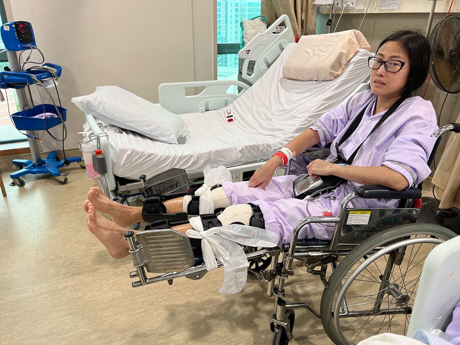 In a Wheelchair Post Knee Surgery for Spontaneous Bilateral Patellar Tendon Rupture