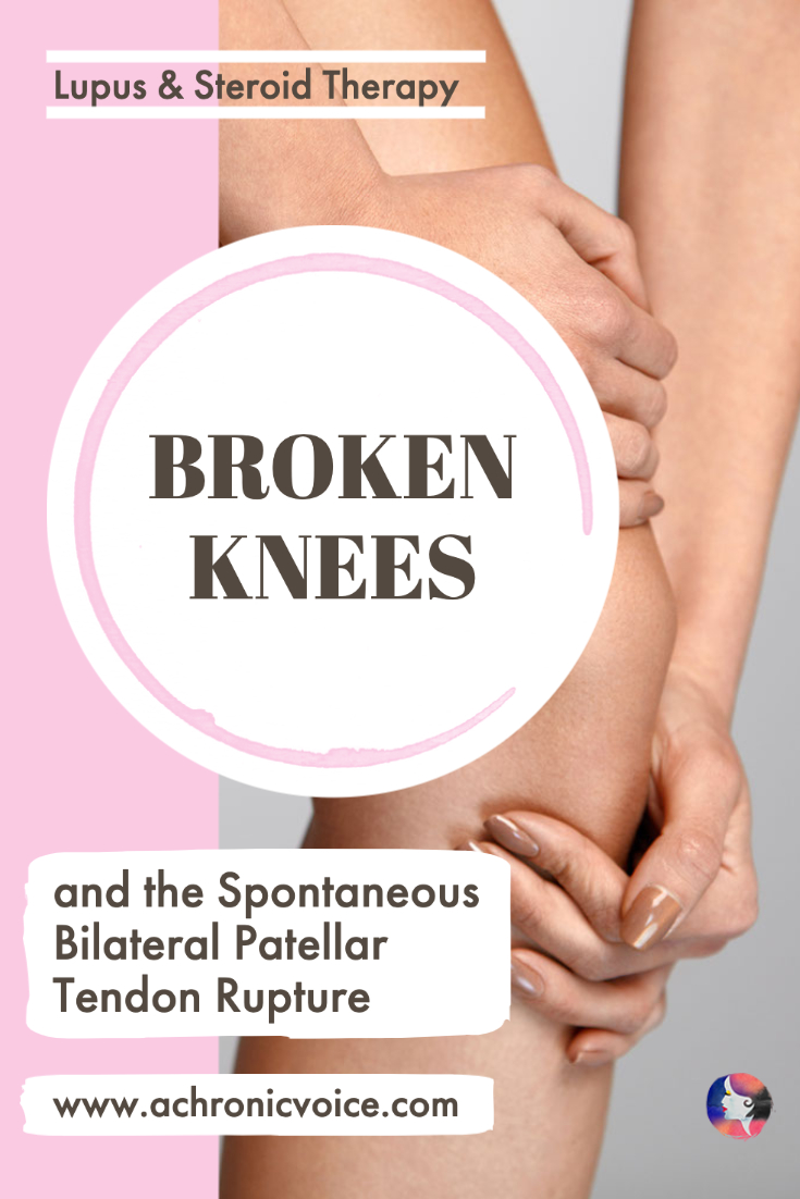 Lupus and Steroid Therapy, Broken Knees and the Subsequent Spontaneous Bilateral Patellar Tendon Rupture