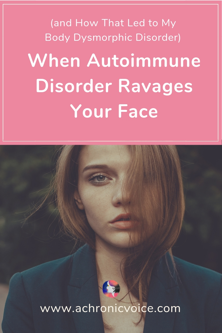 When Autoimmune Disorder Ravages Your Face (And How That Led To My Body Dysmorphic Disorder)