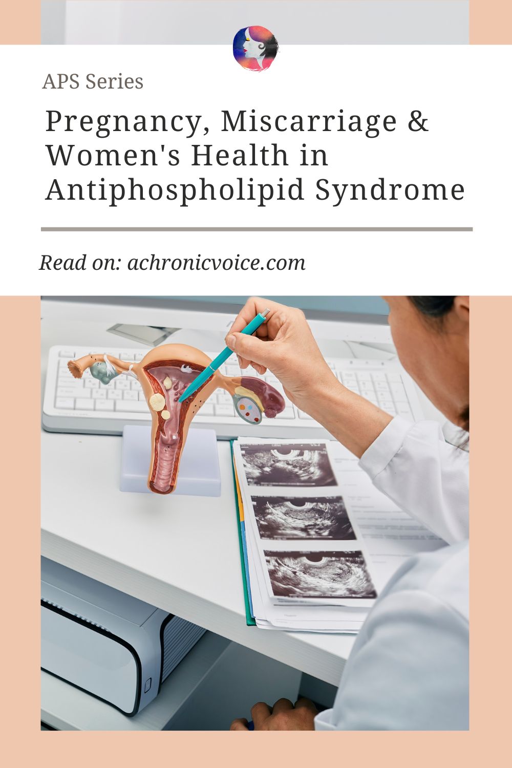 APS Series: Pregnancy, Miscarriage, and Women's Health in Antiphospholipid Syndrome. Read on: A Chronic Voice .com.