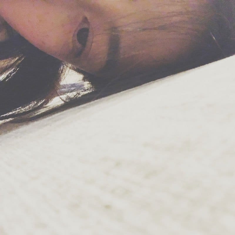 Lying down in pain at the dentist's - read more at www.achronicvoice.com