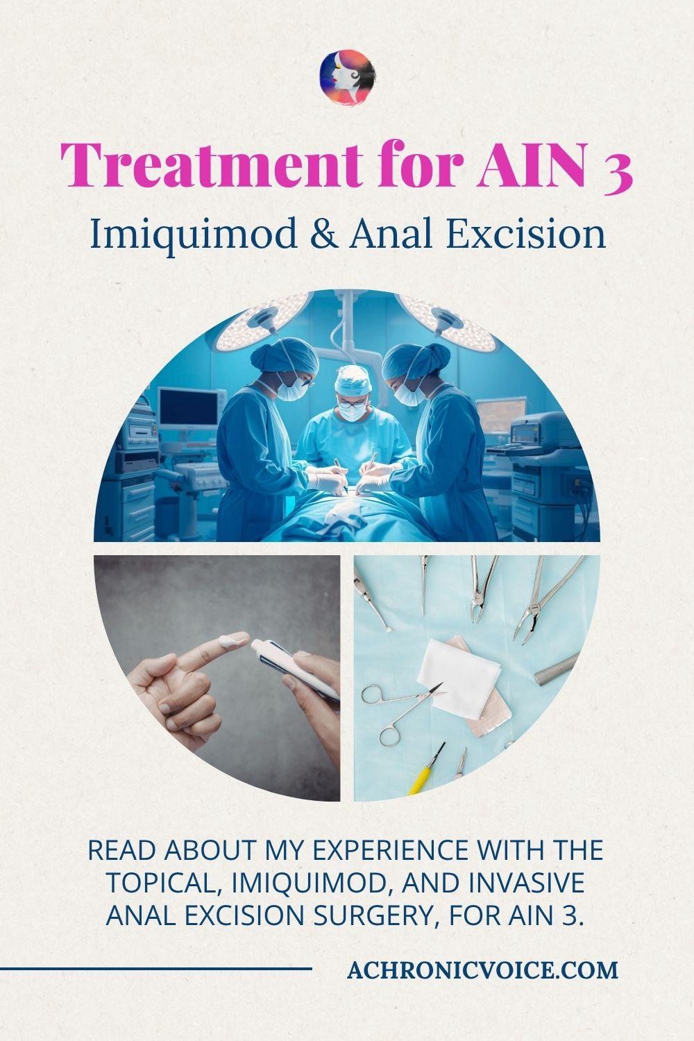 Treatment for AIN 3 — Imiquimod and Anal Excision. Read about my experience with the topical, Imiquimod, and invasive anal excision surgery, for AIN 3, on: A Chronic Voice .com.