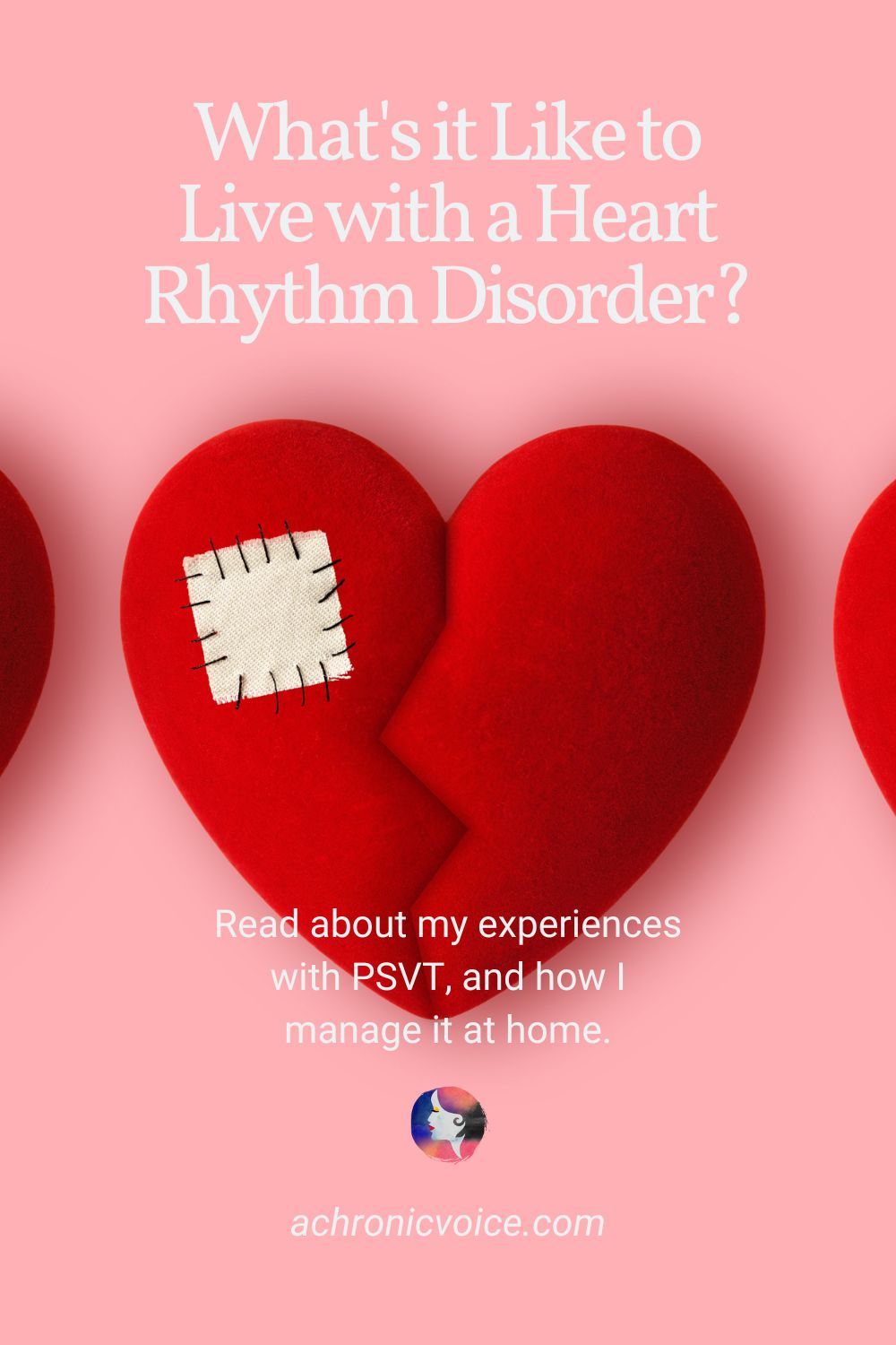 What’s it Like to Live with a Heart Rhythm Disorder? Read about my experiences with PSVT, and how I manage it at home.
